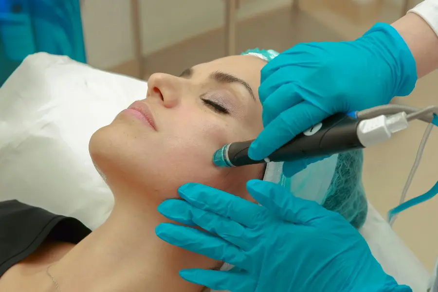 acne treatments image